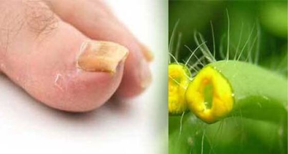herba de celidonia para unha fungo do pé