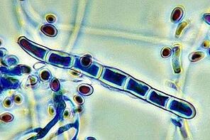 patóxeno de fungos das unhas baixo un microscopio