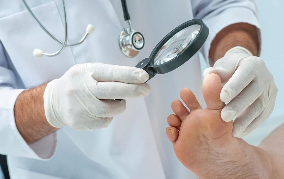 O médico examina as uñas para detectar fungos